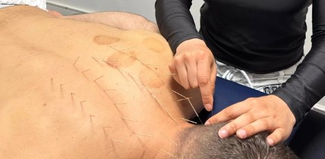 Detail of a treatment session